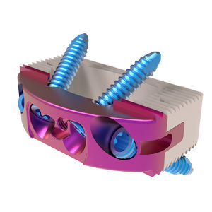 gabbia intersomatica toraco-lombare 1