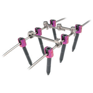 sistema di osteosintesi toraco-lombare 1