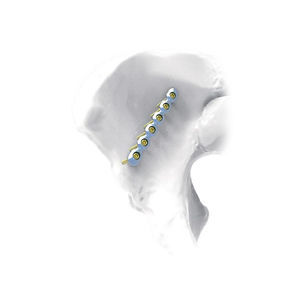 placca di compressione per bacino 1