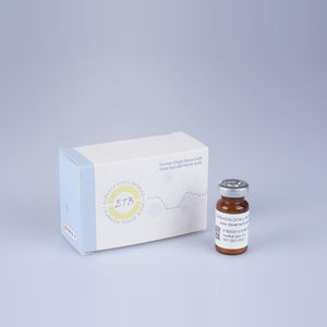 sostituto osseo allotrapianto 1