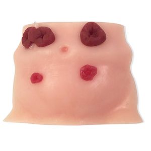simulatore di paziente per cura di stomie