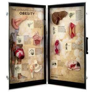 modello anatomico bariatrico