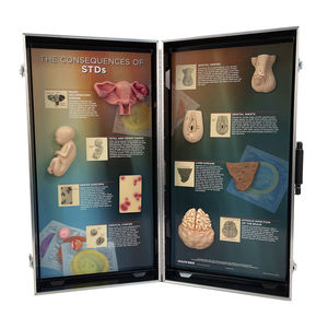 modello anatomico di fegato