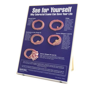 kit di presentazione di modello anatomico di colon