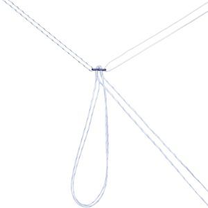 bottone da sutura per ricostruzione dell'LCA