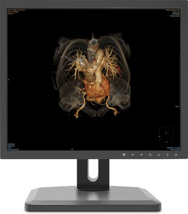 monitor diagnostico