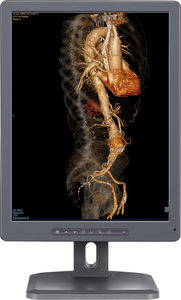 monitor diagnostico