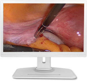 monitor per endoscopia