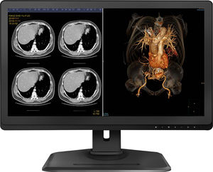 monitor QHD