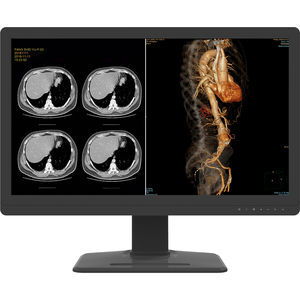 monitor 3840 × 2160