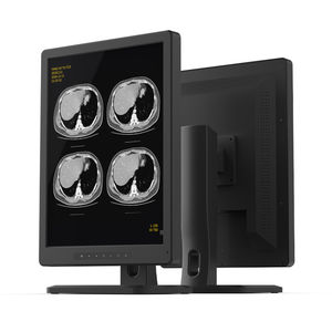 monitor diagnostico