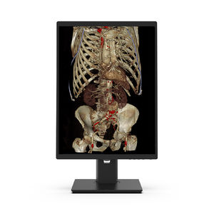 monitor diagnostico