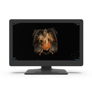 monitor diagnostico
