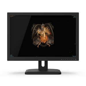 monitor diagnostico