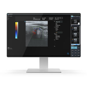 computer medicale Intel® Core i7