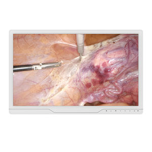 monitor per endoscopia