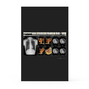 monitor medico