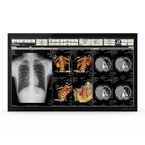monitor medico