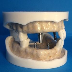 modello anatomico gengivale