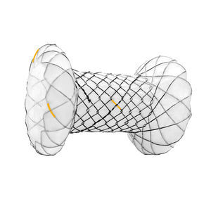 stent pancreatico