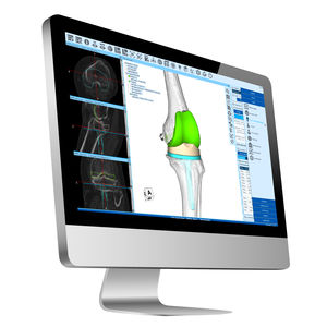 software di pianificazione / per tomografia computerizzata / per ospedale
