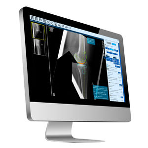 software per chirurgia ortopedica