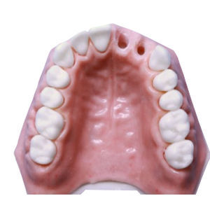 modello anatomico di mascella