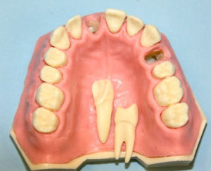 modello anatomico di mascella