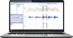 software di analisi 1