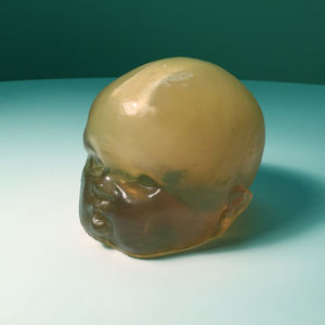 phantom di calibrazione per ecografia