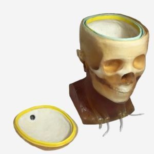 phantom di calibrazione per radiografia