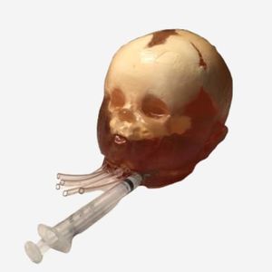 phantom di calibrazione per radiografia