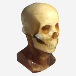 phantom di calibrazione per radiografia