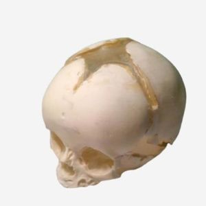 phantom di calibrazione per ecografia