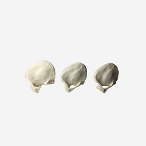 phantom di calibrazione per ecografia
