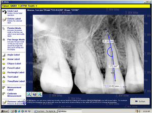 software per imaging odontoiatrico