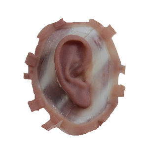 protesi estetica padiglione auricolare