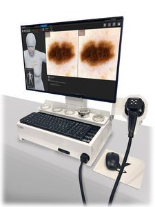 videodermatoscopio