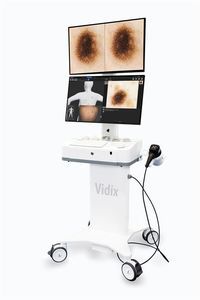 videodermatoscopio