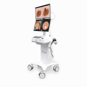 videodermatoscopio