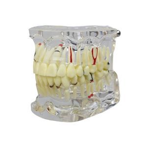 modello anatomico di dentatura 1