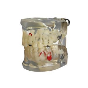 modello anatomico di denti 1