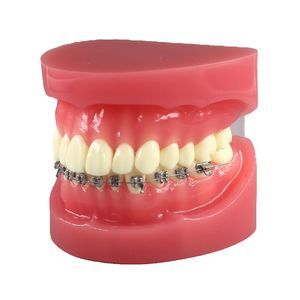 modello anatomico di denti 1