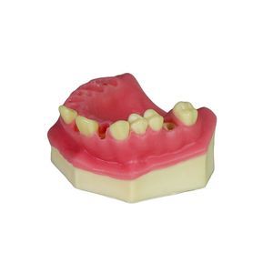 modello anatomico gengivale 1