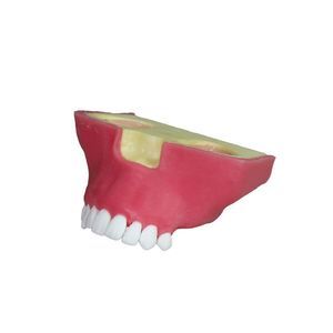 modello anatomico di seno nasale 1