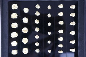 modello anatomico di denti 1