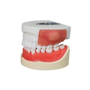 modello anatomico di denti 1