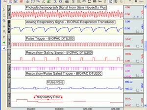 fotopletismografo respiratorio