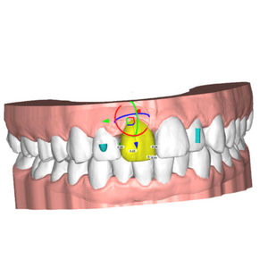 software per laboratorio dentale