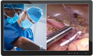 monitor medico